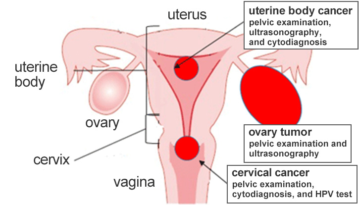 figure1