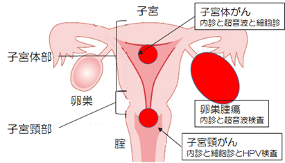 図1子宮海岸健診